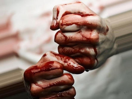 Свежие новости: В Николаеве парни подрались из-за девушки: один в тяжелом состоянии в больнице, другому «светит» тюрьма