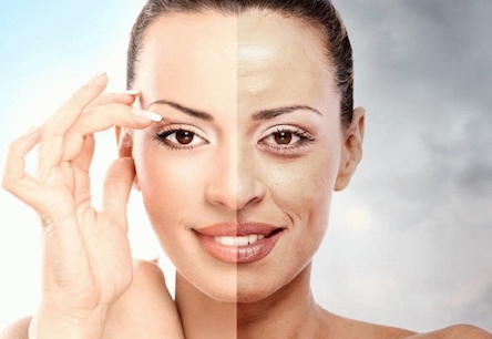 Свежие новости: Что такое косметологический химический пилинг?