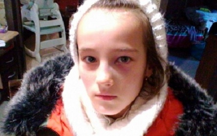 Свежие новости: ВИДЕО: В Южноукраинской школе на уроке физкультуры третьекласснице сломали нос