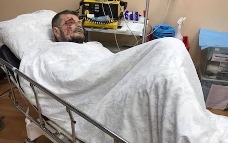 Свежие новости: Покушение на Мосийчука: нардеп дал СБУ показания