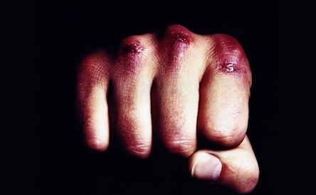 Свежие новости: В Одессе 28-летний мужчина избил свою бабушку ради двухсот гривен