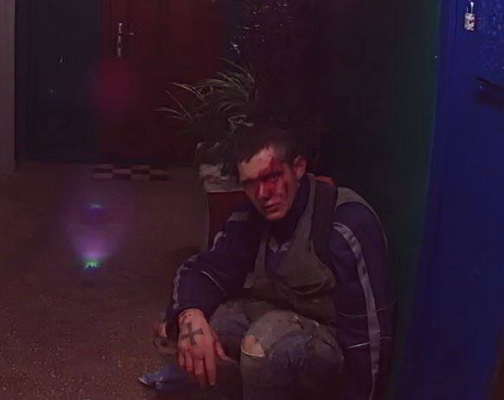 Свежие новости: В Одессе неизвестные избили живодера, убивавшего животных в присутствии ребёнка