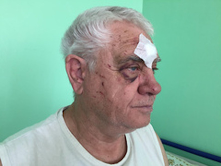 Свежие новости: В Харькове участковый во время конфликта в трамвае разбил лицо пенсионеру 18+