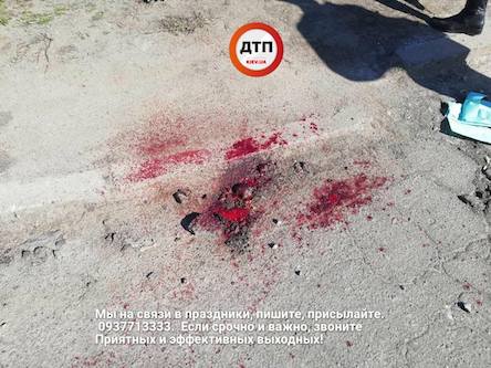 Свежие новости: ФОТО: В киевской маршрутке мужчина лишился скальпа