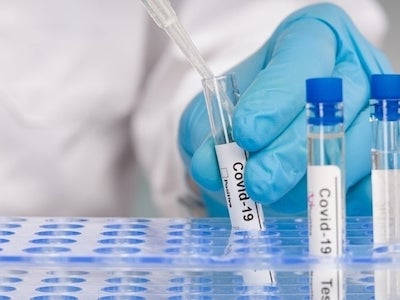 Свежие новости: В Украине произошла вспышка COVID-19 на птицефабрике