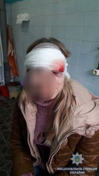 Свежие новости: В Николаевской области мужчина похитил жену, угрожая убить её и себя, совершив ДТП на трассе