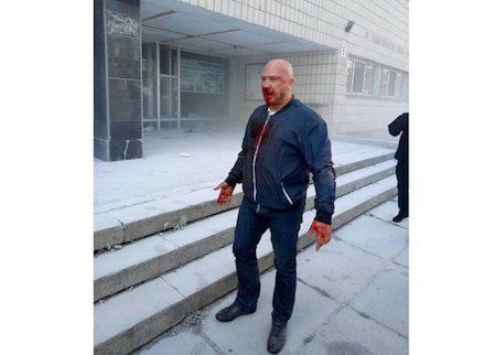 Свежие новости: Бойня в Киеве: почему копы «защищают» бандитов