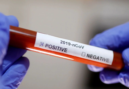 Свежие новости: В умершей роженицы на Прикарпатье подтвердили коронавирус