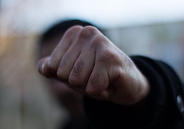 Свежие новости: В Николаеве жестоко избили гостя развлекательного заведения – полиция разыскивает нападавших