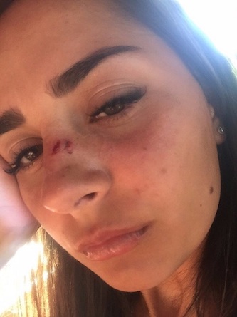 Свежие новости: В Турции жестоко избили туристов из России: опубликованы фото, видео и детали инцидента