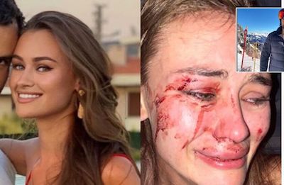 Свежие новости: Подробности скандала: Избиение украинской модели в Турции