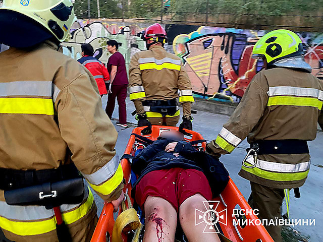 Свежие новости: У Миколаєві дівчинку, яка впала у 10-метровий колодязь, дістали рятувальники