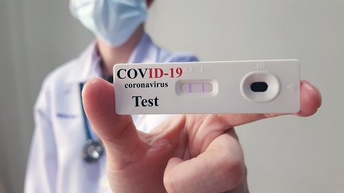 Фото новости: Николаевская область получит 23 тысячи экспресс-тестов на COVID-19 Свежие новости: Николаевская область получит 23 тысячи экспресс-тестов на COVID-19