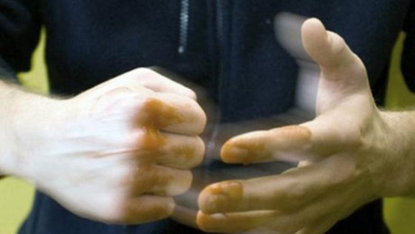 Свежие новости: В Николаеве неизвестные проломили парню череп