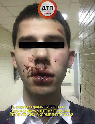 Свежие новости: В Киеве двое выходцев с Кавказа жестоко избили и прокатили на капоте пешехода, сделавшего замечание