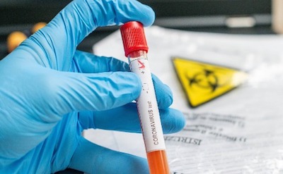 Свежие новости: Одесса переходит в «оранжевую зону»