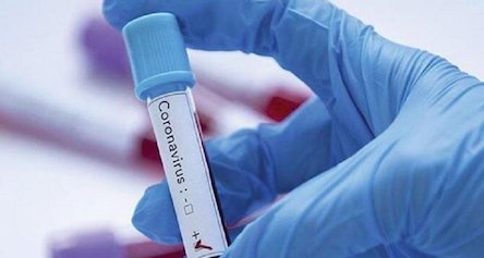 Свежие новости: Тестирование николаевцев на COVID-19 и их лечение оплачиваются государством, - главврач «инфекционки»