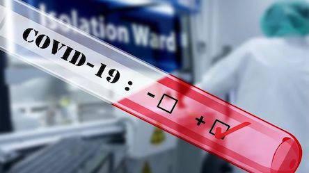 Свежие новости: COVID-19: оперативна інформація в Миколаєві станом на 17 квітня