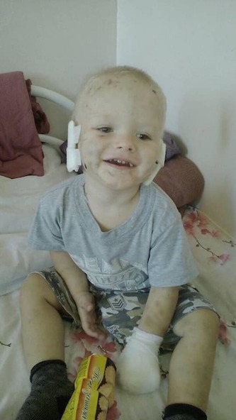 Свежие новости: Собака отгрызла уши и пальцы: в Славянске произошло жуткое ЧП с ребенком