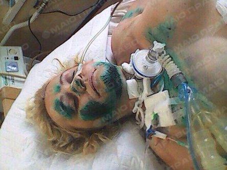 Свежие новости: Близкие девушки, которая попала в жуткую аварию, просят помощи у жителей Николаевщины