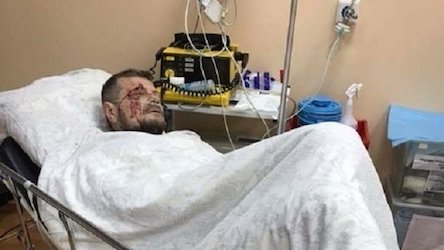 Свежие новости: Мосийчук рассказал о своем состоянии после покушения