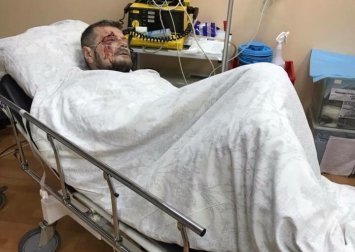 Свежие новости: Покушение на Мосийчука: нардеп намекнул, где искать исполнителей