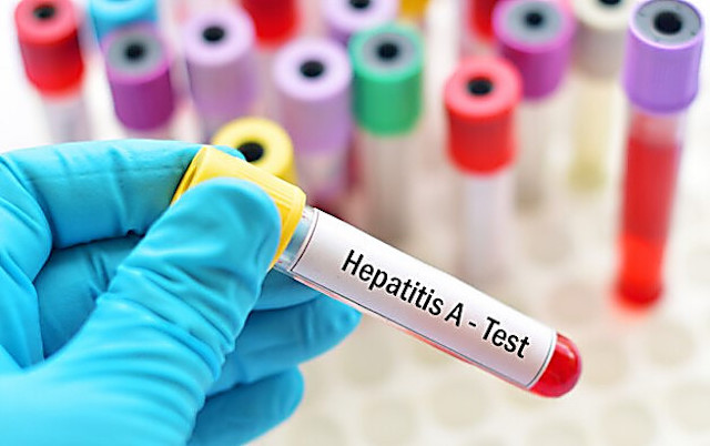 Свежие новости: В МОЗ оголосили, що на Вінниччині погасили спалах гепатиту А