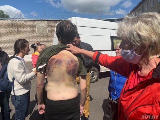 Фото новости: Нечеловеческая жестокость: в сети показали фото зверски избитых протестующих в Беларуси Свежие новости: Нечеловеческая жестокость: в сети показали фото зверски избитых протестующих в Беларуси