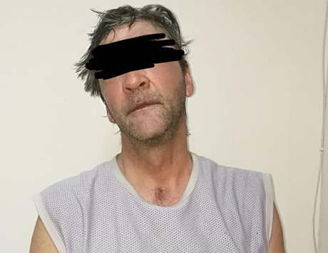 Свежие новости: В Одессе поймали мужчину, который облил кислотой мальчика, игравшего у него под окнами