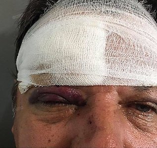 Свежие новости: Николаевец набросился на водителя автобуса