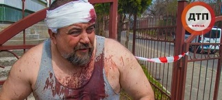 Свежие новости: Стрельба в скандальном доме «Арбузова» на Обуховской в Киеве: все подробности конфликта