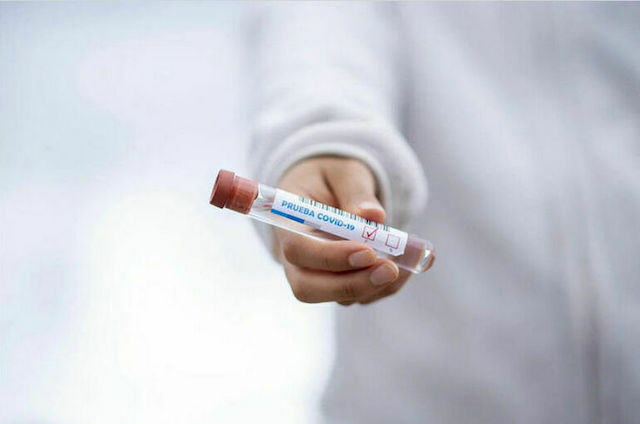 Свежие новости: В Николаевской области продолжает расти заболеваемость COVID-19