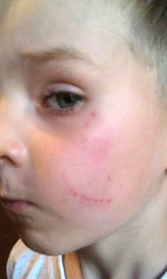 Свежие новости: Расправа над ребенком в детсаду под Киевом: появилась реакция власти