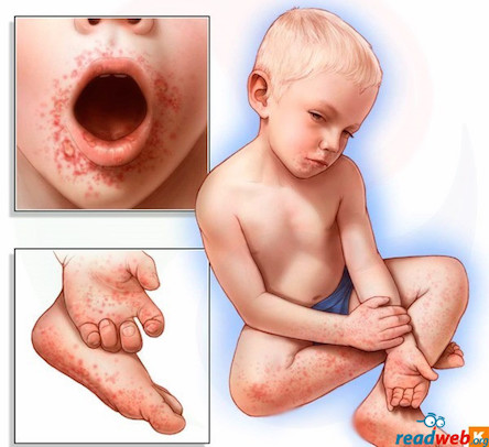 Свежие новости: Украинцев косит турецкий вирус: в больницы Кривого Рога уже попали 14 человек