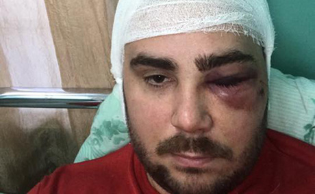 Свежие новости: В Запорожье подстрелили одного из руководителей Автоевросилы