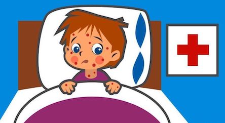 Свежие новости: Корь не уходит: за неделю заболели 25 жителей Одессы