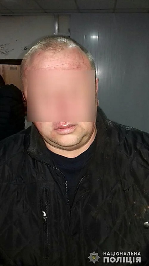 Свежие новости: Николаевец из-за фейерверка стал стрелять и ранил ребенка