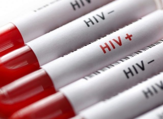 Свежие новости: В этом году в Николаевской области 398 случаев ВИЧ