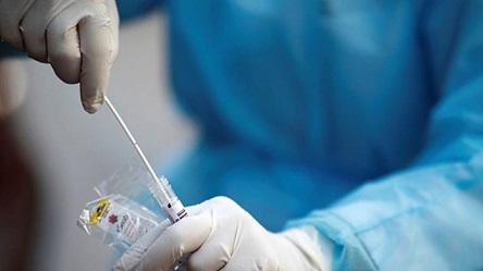 Свежие новости: Всем заболевшим Covid-19 в Коблево оказана медицинская помощь, а контактные лица находятся на самоизоляции