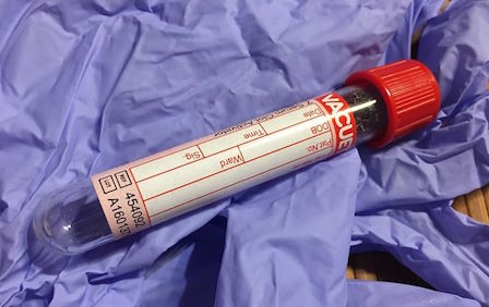 Свежие новости: Массовое отравление детей на курорте в Коблево: все подробности