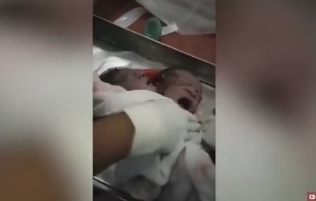 Фото новости: В Черновцах родился ребенок с двумя головами Свежие новости: В Черновцах родился ребенок с двумя головами