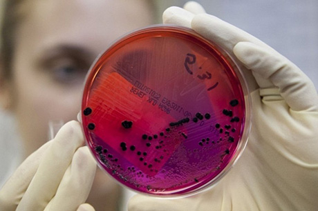 Свежие новости: В Одесской области пять человек госпитализировали с сибирской язвой