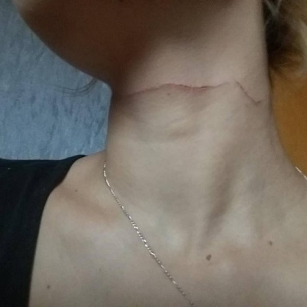 Свежие новости: В Южноукраинске незнакомец попытался перерезать горло девушке