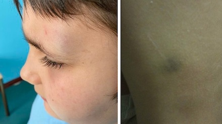 Свежие новости: В Николаеве 8-летнего ребенка избила медработница в больнице