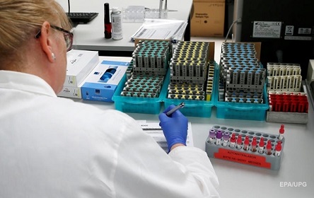 Свежие новости: В Украине произвели первую партию ПЦР-тестов