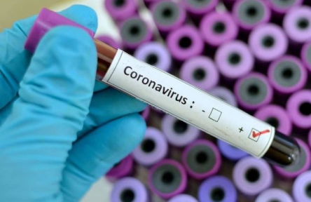 Свежие новости: +92: В Украине зафиксировано уже 310 случаев COVID-19 - Минздрав