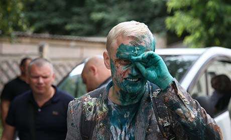 Свежие новости: Антикоррупционера Шабунина на митинге против главы САПУ облили зеленкой - активист обратился к медикам