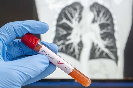 Свежие новости: В Николаевской области за сутки выявили 6 новых случаев COVID-19