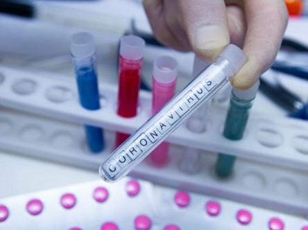 Свежие новости: В Украине пока не зарегистрировано ни одного подтвержденного случая коронавируса - МОЗ