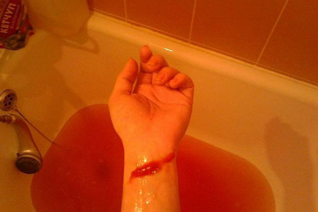 Свежие новости: В Николаеве пенсионер пытался совершить суицид